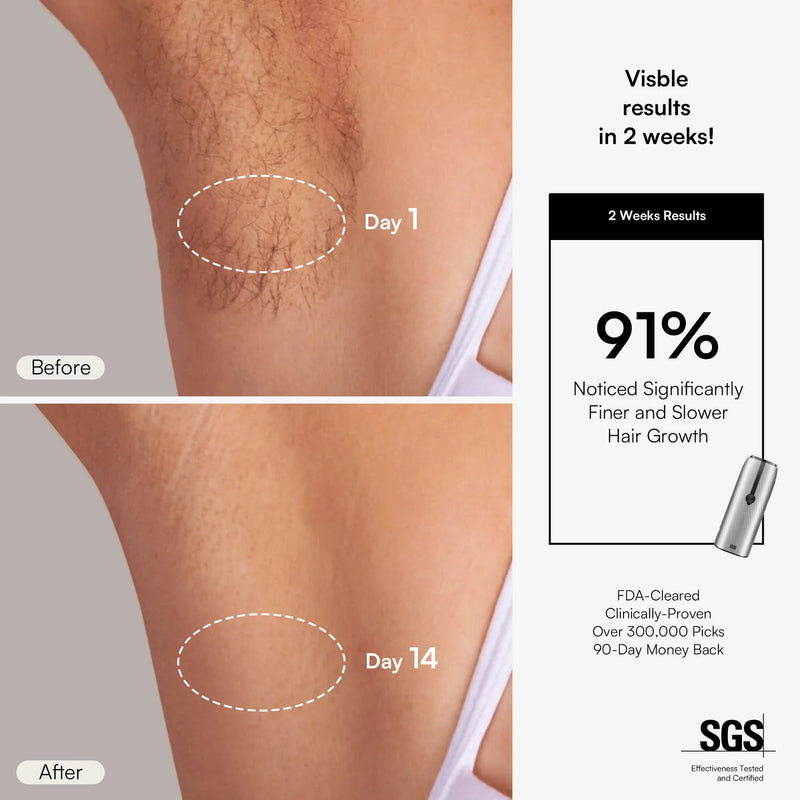 Nuvio IPL Hair Removal Device